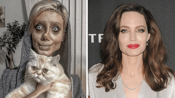 Oplas 50 Kali Demi Mirip Angelina Jolie, Gadis Ini Malah Mirip Zombie
