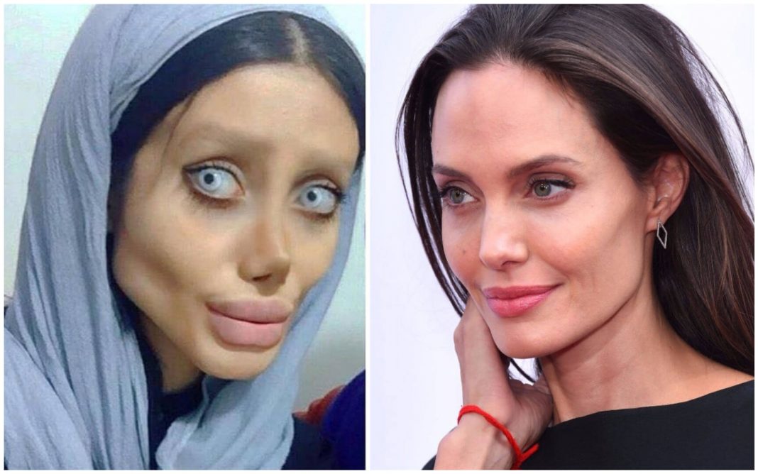 Oplas 50 Kali Demi Mirip Angelina Jolie, Gadis Ini Malah Mirip Zombie