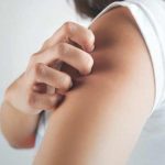 Menderita Psoriasis Kurangi Konsumsi Makanan Ini-cover