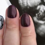 Ultrasound Nail Art: Yay or Nay?