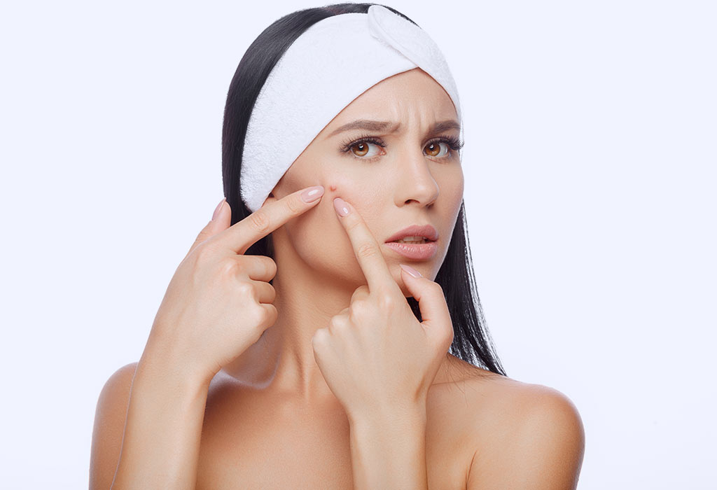 Rekomendasi Skincare Bahan Herbal untuk Atasi Jerawat