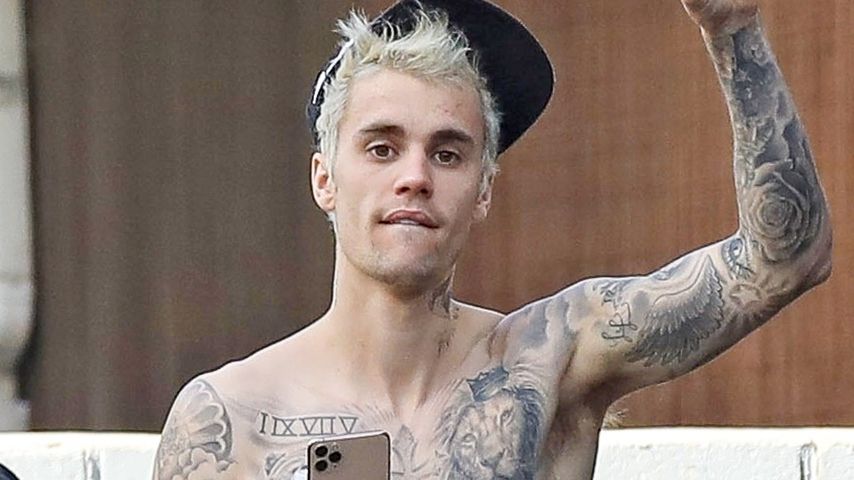 Setelah ‘Depresi Berat', Justin Bieber Akui Dirinya Alami Penyakit Lyme
