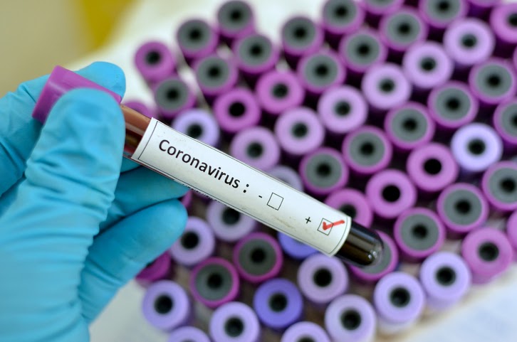 Waspadai Corona Virus dengan Melakukan Berbagai Pencegahan Berikut