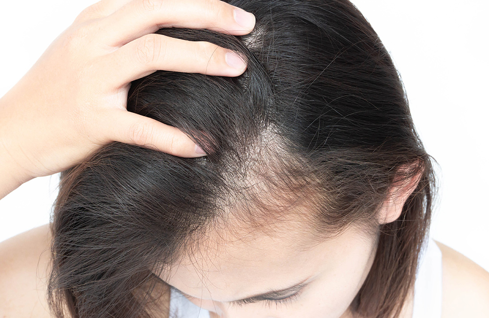 Faktor Penghambat Pertumbuhan Rambut dan Cara Mengatasinya Menurut Para Ahli