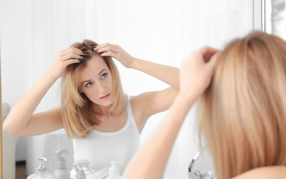 Tips Mengatasi Garis Rambut yang Mulai Menipis atau Menurun