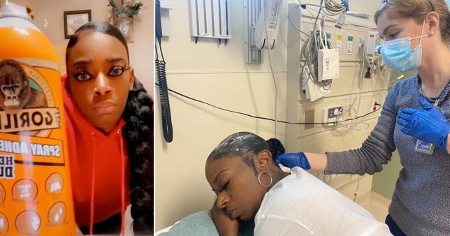 Kabar Terbaru Wanita yang Dirawat di Rumah Sakit Karena Tata Rambut dengan Gorilla Glue