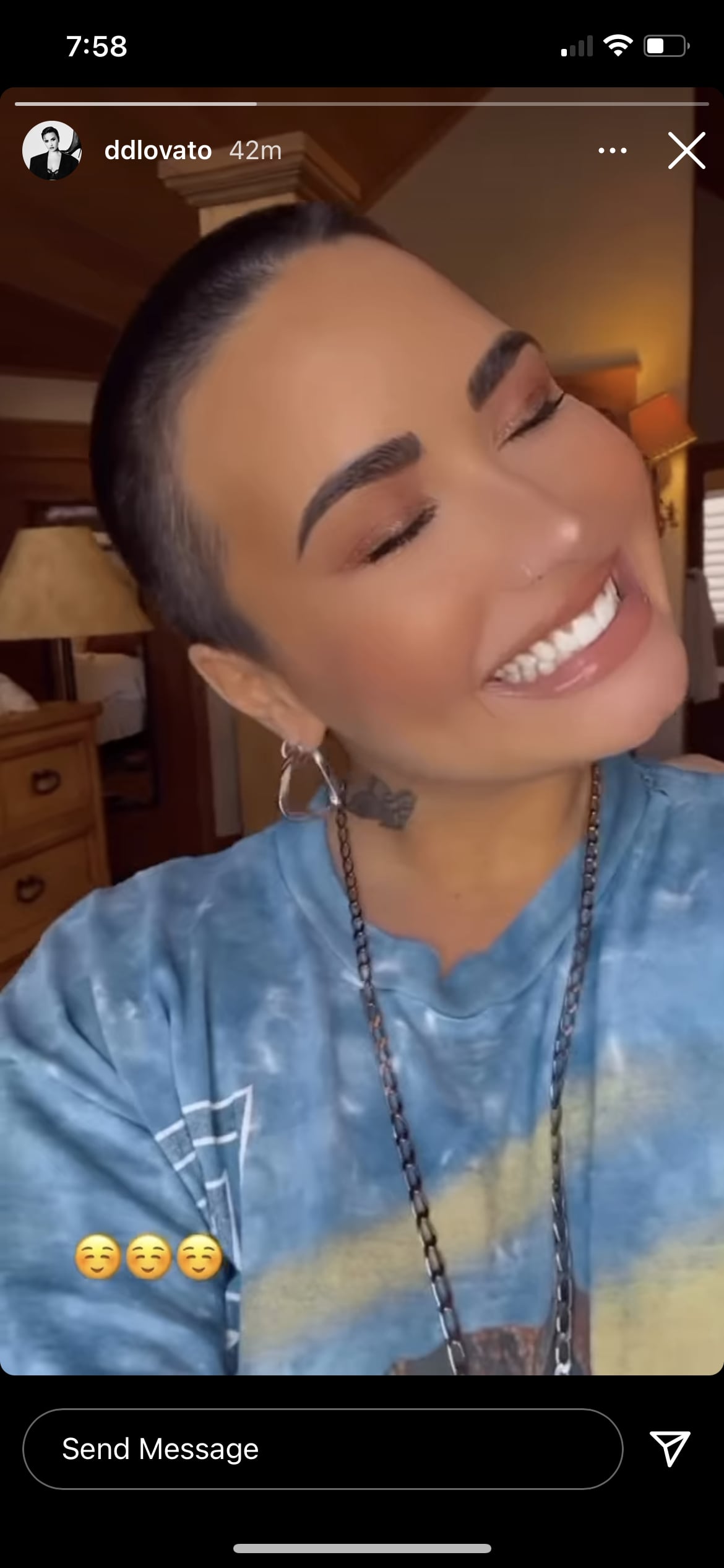 Demi Lovato Pamer Gaya Rambut Nyaris Botak Sebagai Tanda Awal yang Baru