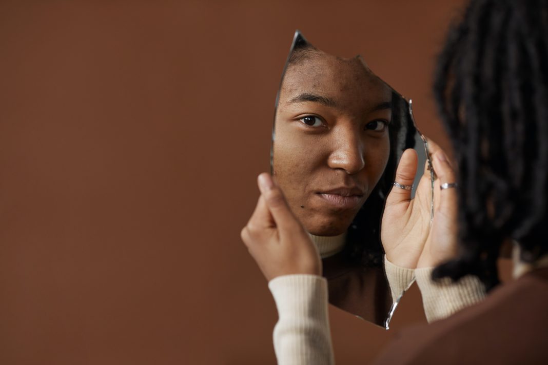 5 Aturan Makeup untuk Kulit Tipe Acne Prone