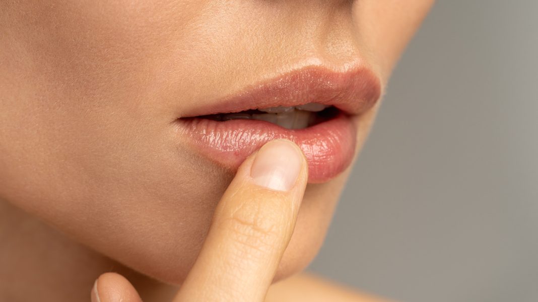 Tips Sederhana Merawat Bibir yang Terkena Sunburn