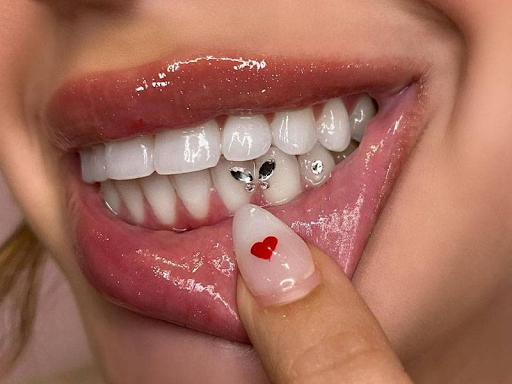 Tooth Gem, Aksesoris Permata Gigi Y2K yang Comeback Tahun Ini