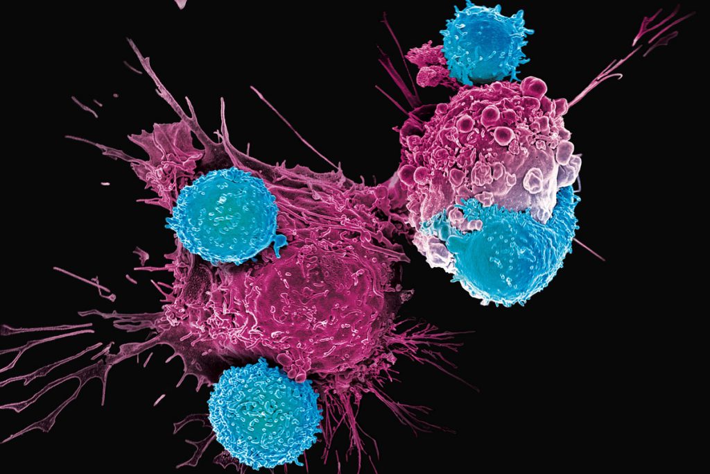 Terapi Sel Kanker Tua Terobosan Baru dalam Pengobatan Kanker