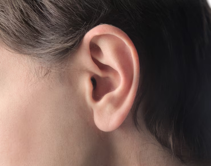 Cara Terbaik Menghilangkan Jerawat di Telinga Menurut Dokter Kulit