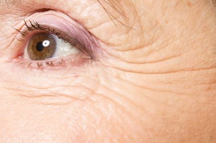 Kulit Keriput Mengatasi dan Mencegah Tanda Penuaan pada Wajah