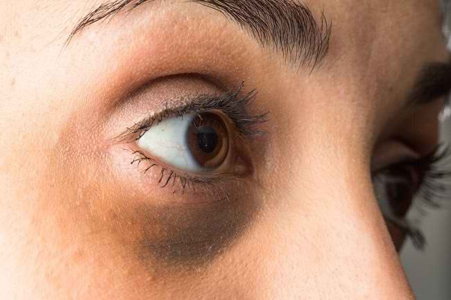 Dampak Dehidrasi pada Penglihatan Anda Penting Untuk Diketahui